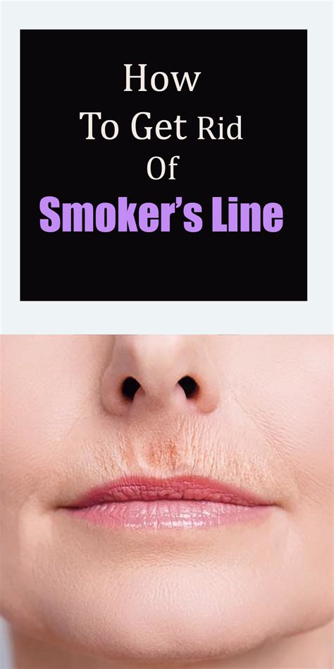 How To Get Rid Of Smokers Line Smokers Lines How To Line Lips