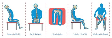 Postural Evaluation In Sitting Let Your Hands Mimic The Possibilities