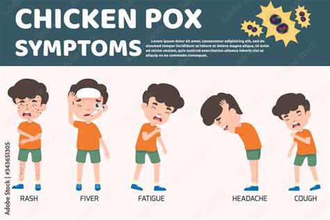 Children Has Chicken Pox Infographic Poster Children Fever And