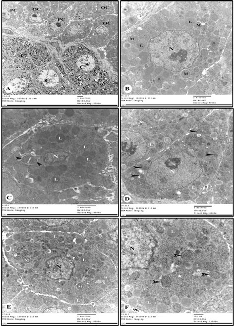 Electron Micrographs Of Cortical Cells Showing A Polyhedral Pc And
