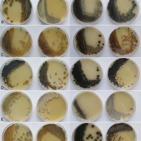 Morphology Of Hortaea Werneckii Cultures On Malt Extract Agar Mea