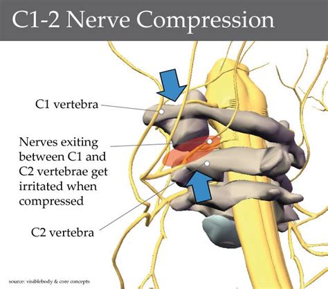 C1 C2 Nerve Compression Chiropractic Pinterest Knee Pain Pain D