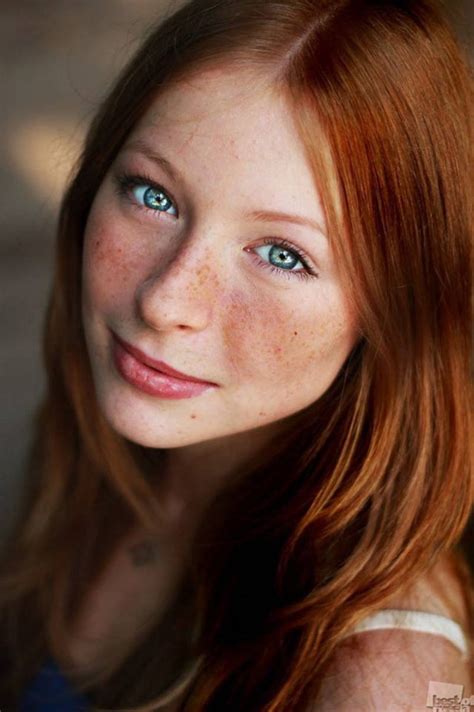 Unknown Freckled Redhead Freckledredheads