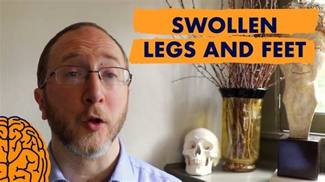 Multiple Sclerosis Symptoms Video Swollen Legs And Feet Youtube