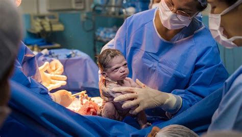Photographer Captures Moment Newborn Baby Gives Doctors A Death Stare