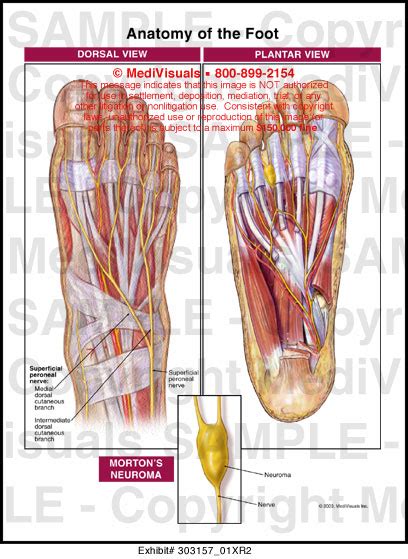 Anatomy Of The Foot Medical Illustration Medivisuals