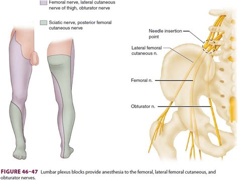 Lower Extremity Peripheral Nerve Blocks Posterior Lumbar Plexus Psoas