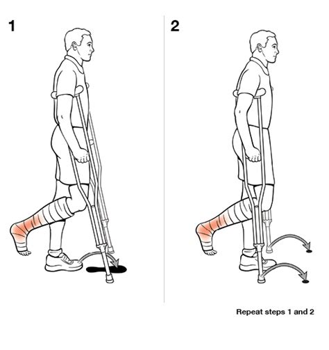 Step By Step Using Crutches With Swing To Non Weight Bearing Saint