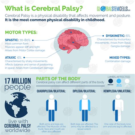 Cerebral Palsy Treated With Physiotherapy And Stem Cell Treatment Gsc