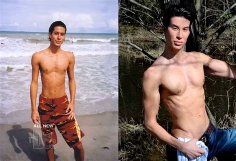 Justin Jedlica Human Ken Doll Had 128 Plastic Surgeries Ecanadanow