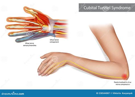 Ulnar Nerve Anatomy Human Elbow Anatomy With Bones Muscles Cartoon
