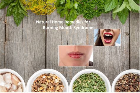 Natural Home Remedies For Burning Mouth Syndrome And Lifestyle Changes