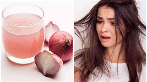 Benefits Of Onion On Hair How To Use And Make Vhealthprime