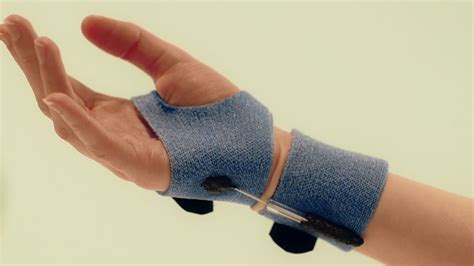 Anti Wrist Radial Deviation Orthosis Orficast Instructional Movie 17