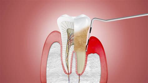 Perudentus Clinica Dental En Huaraz Una Clínica A Tu Nivel