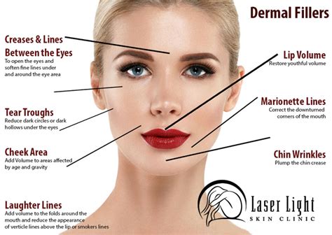 Lip Plumping And Wrinkle Fillers Laser Light Skin Clinic