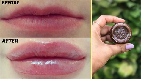 How To Get Bigger And Fuller Lips Naturally In Just 5 Minutes Home