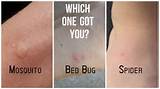 Pictures of How To Get Rid Of Bed Bugs Cdc