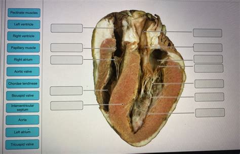 Solved Pectinate Muscles Left Ventricle Right Ventricle Chegg