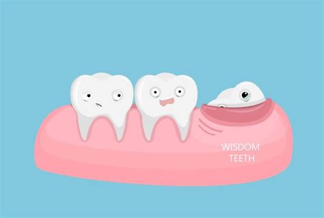 The Enigmatic Evolution Unveiling The History Of Wisdom Teeth Synergy