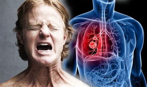 A detailed information about how lung cancer spreads all over the body and how to find its signs in cancer is such topmost blunder of the modern human era. Lung cancer: If you feel a pain in these body parts it ...