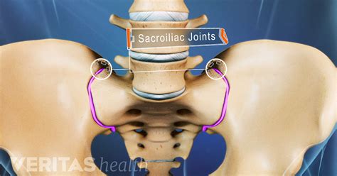 Then repeat the same process. Sacroiliac Joint Dysfunction (SI Joint Pain)