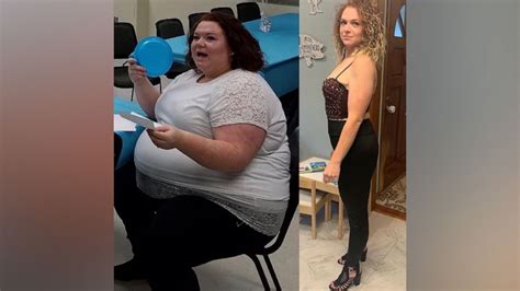 Gastric Bypass Surgery Isnt For Everyone But It Gave This Mom A