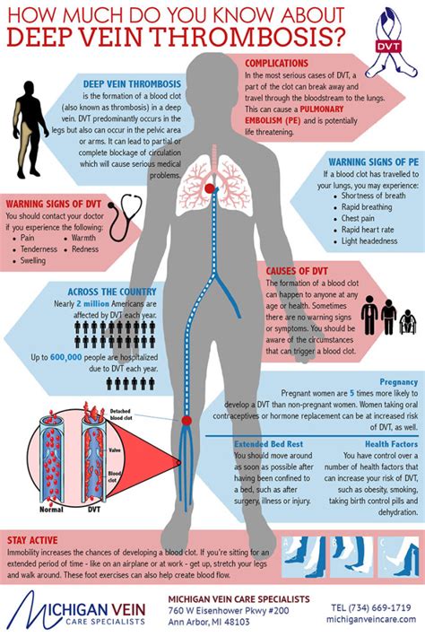 Deep Vein Thrombosis Infographic Michigan Vein Care Specialists