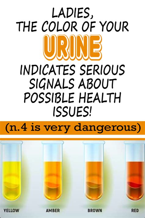 What The Color Of Your Urine And Frequent Urination Can Tell You About
