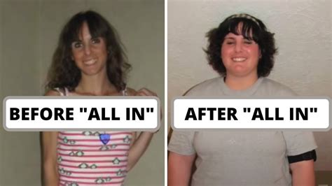 From Anorexia To Binge Eating When All In Recovery Goes Seriously