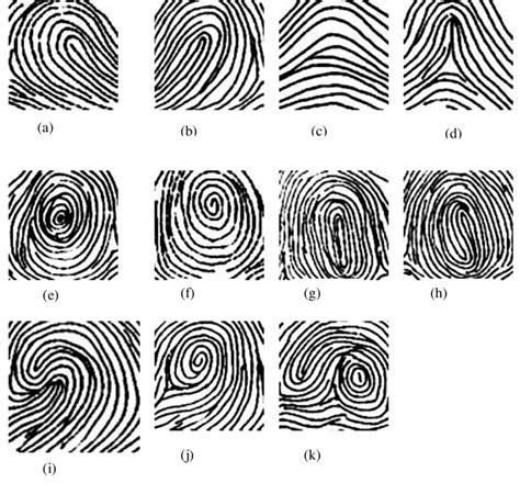 3 Basic Patterns Of Fingerprints A Ulnar Loop B Radial Loop C