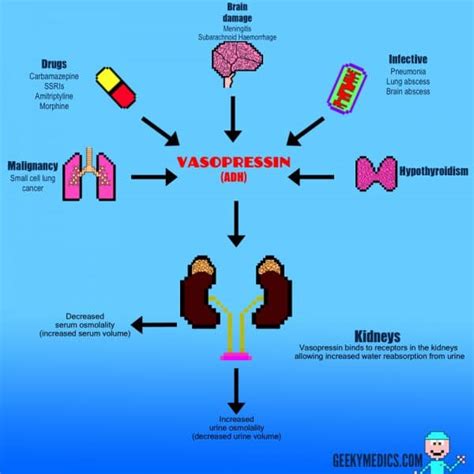 The result is a profound metabolic disturbance. SIADH - Geeky Medics
