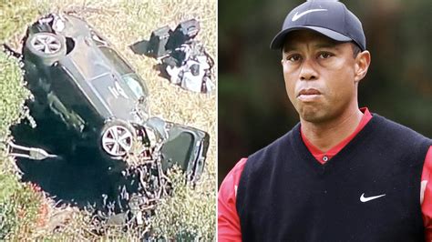 Tiger Woods Golf Legend Hospitalised After Car Crash