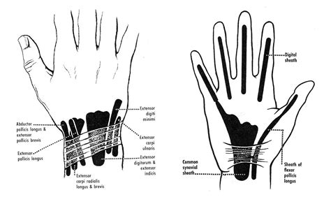 The Extensor And Flexor Tendons And A Common Arrangement Of Their