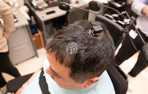 Yapay zekalı beyin implantı felçli hastaya his kazandırdı Megabayt