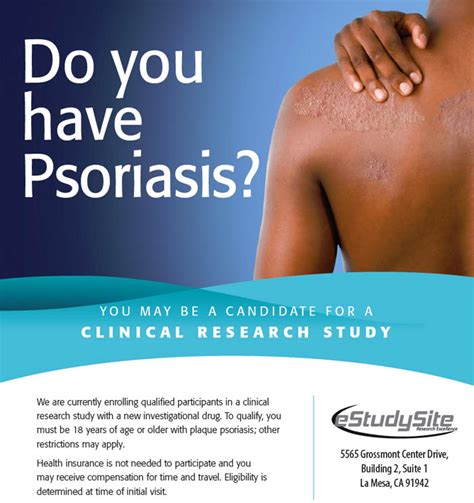 Psoriasis San Diego Ca Clinical Trial 34134