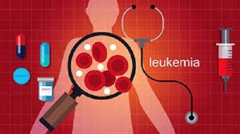 Leukemia Symptoms And Treatments