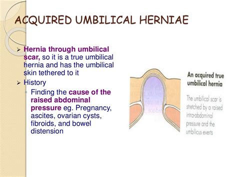 Hernias By Mhr Corp