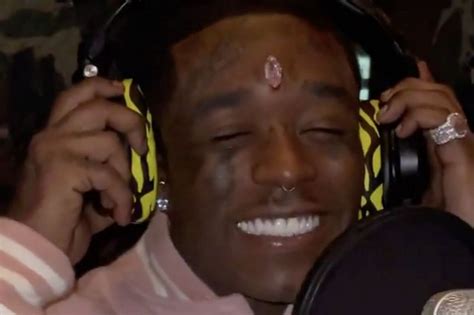 I Could Die Lil Uzi Shares Picture Of Forehead Bleeding After 24