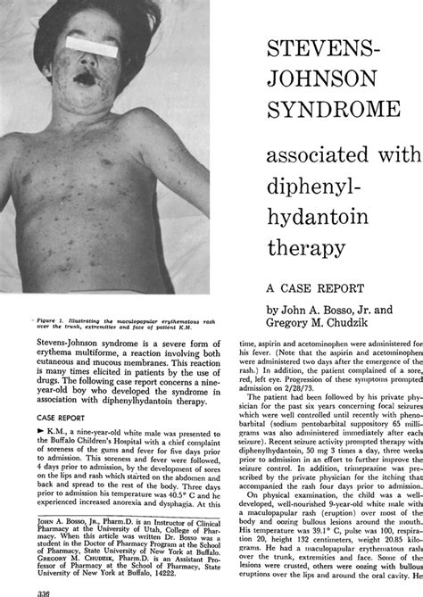 Stevens Johnson Syndrome Associated With Diphenylhydantoin Therapy A