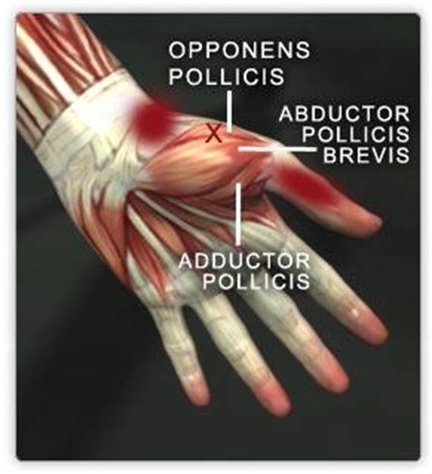 The abductor pollicis brevis muscle is one of the intrinsic muscles of the hand that belongs to the thenar group. muscles of wrist, thumb and fingers - AP Biology 210 with ...