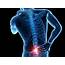 Lower Back Pain Surgery  Types Cost Recovery Sutured