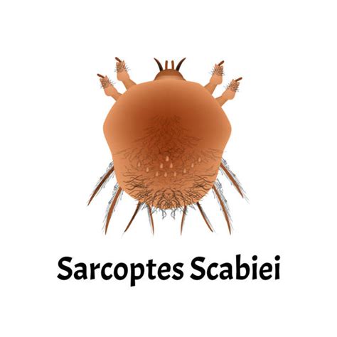 Scabies Skin Illustrations Royalty Free Vector Graphics And Clip Art