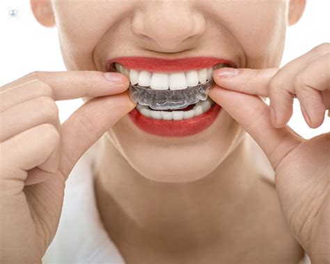 Invisible Orthodontics What Is It Top Doctors