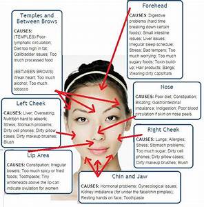 Position Of Acne Can Reveal Your Health Status Ayurveda