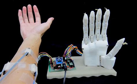 Prosthetic Hand Controls Finger Motion With High Accuracy And Minimal