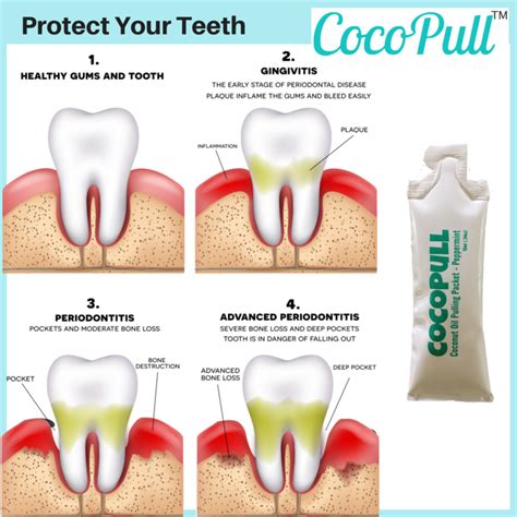 Cocopull Oil Pulling For White Teeth Fresh Breath And Healthy Gums