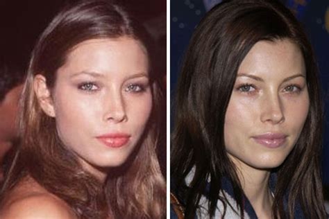 Jessica Biel Plastic Surgery Before And After Bad Plastic Surgery