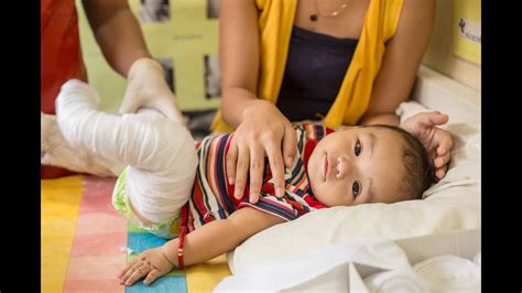 Treating Every Child With Clubfoot Youtube