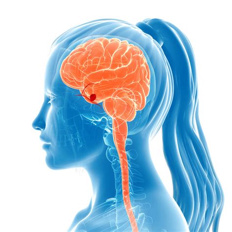 Brain Aneurysm Causes Symptoms Diagnosis And Treatment Dr
